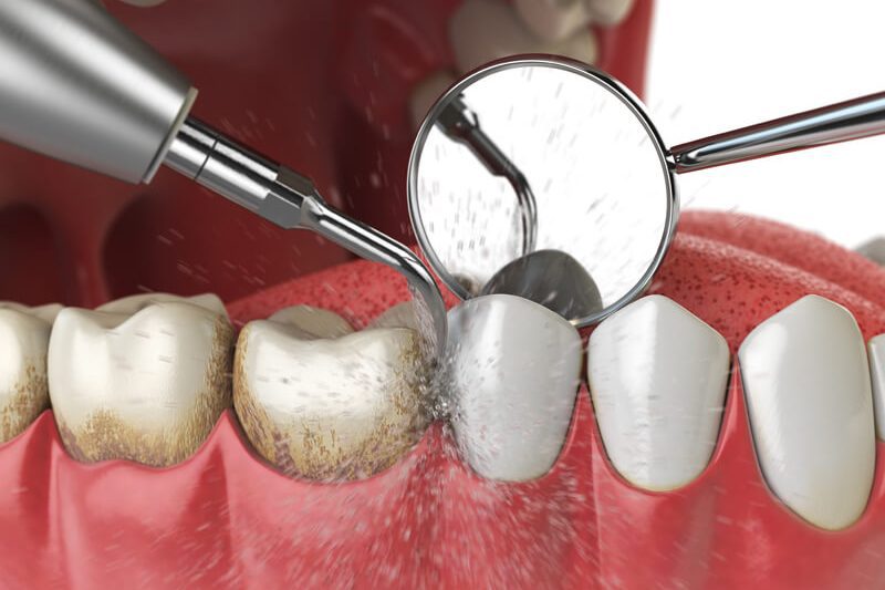 scaling Treatments