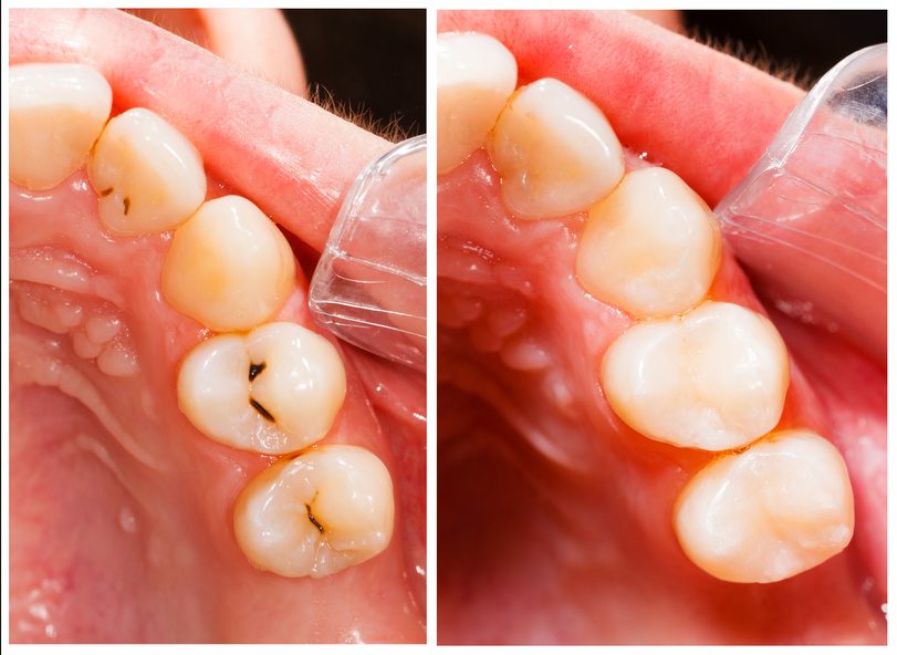 Best Dental in Uttara