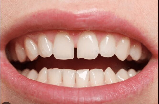 Best dental in Uttara