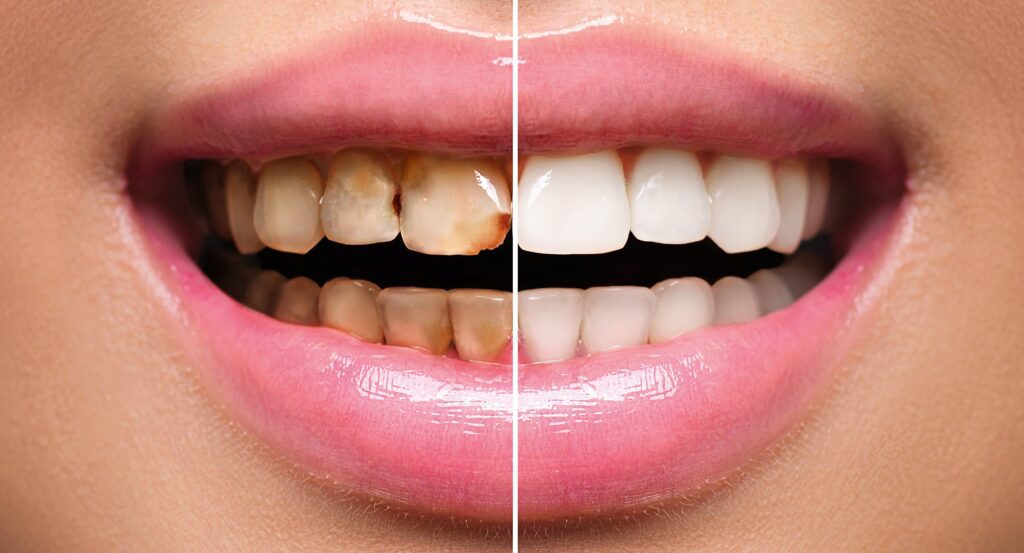 Best dental in Uttara