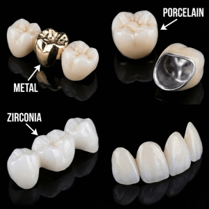 Premium Dental Crowns and Teeth Caps