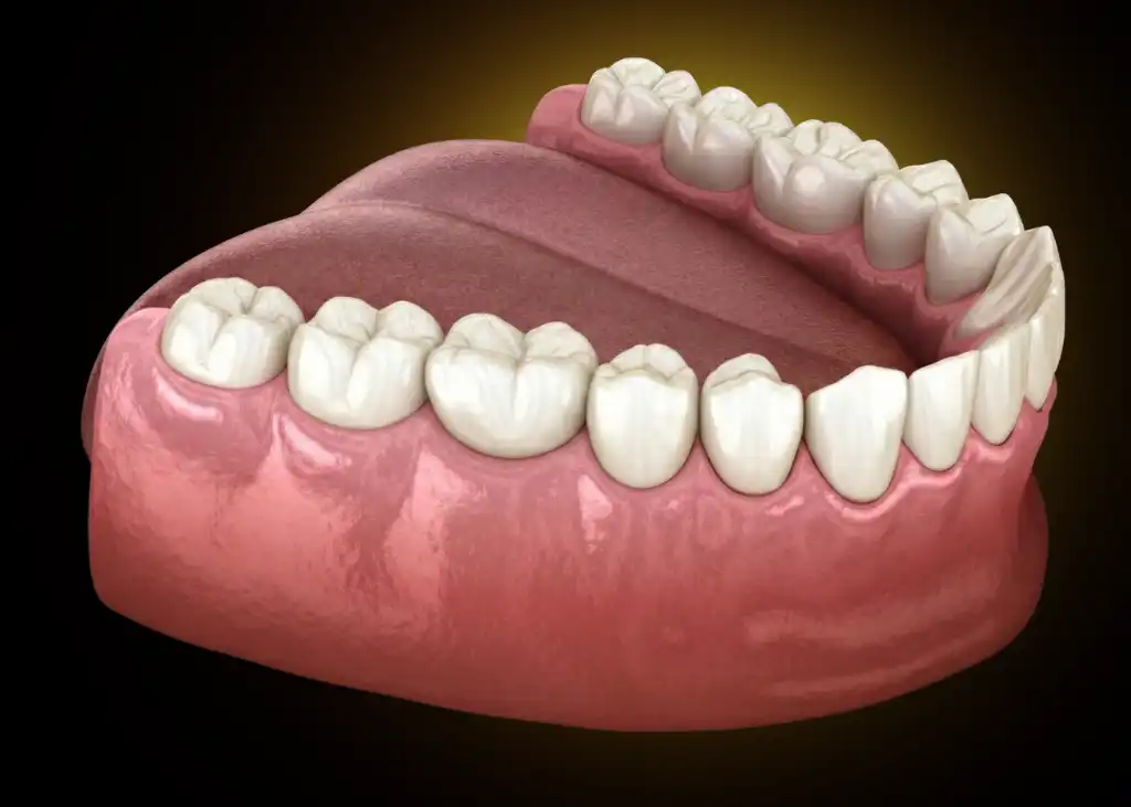 Dental crown after