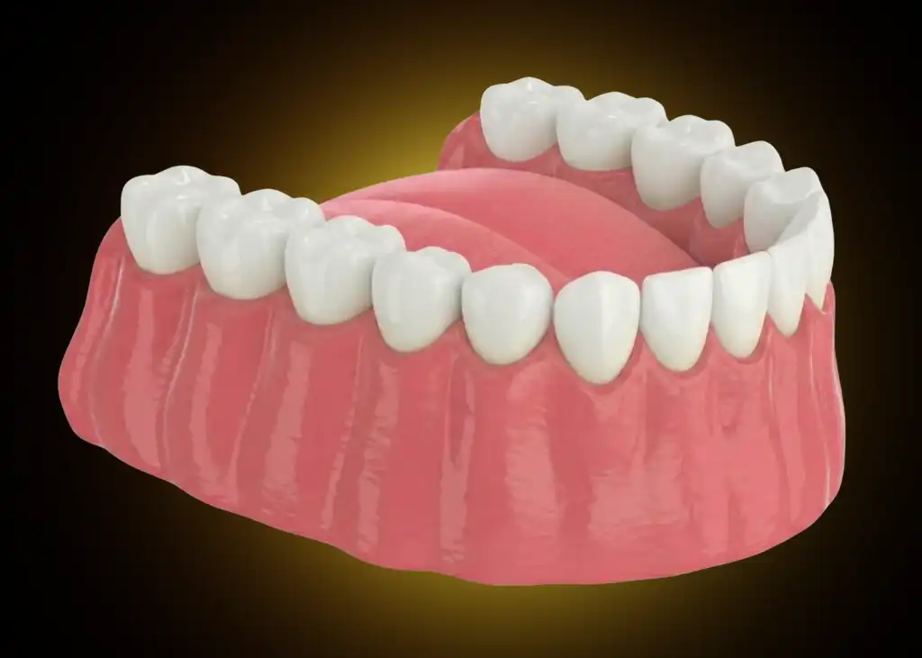 Braces after
