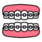 braces