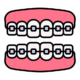 braces