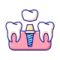 dental-implant