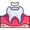 filling