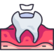 filling